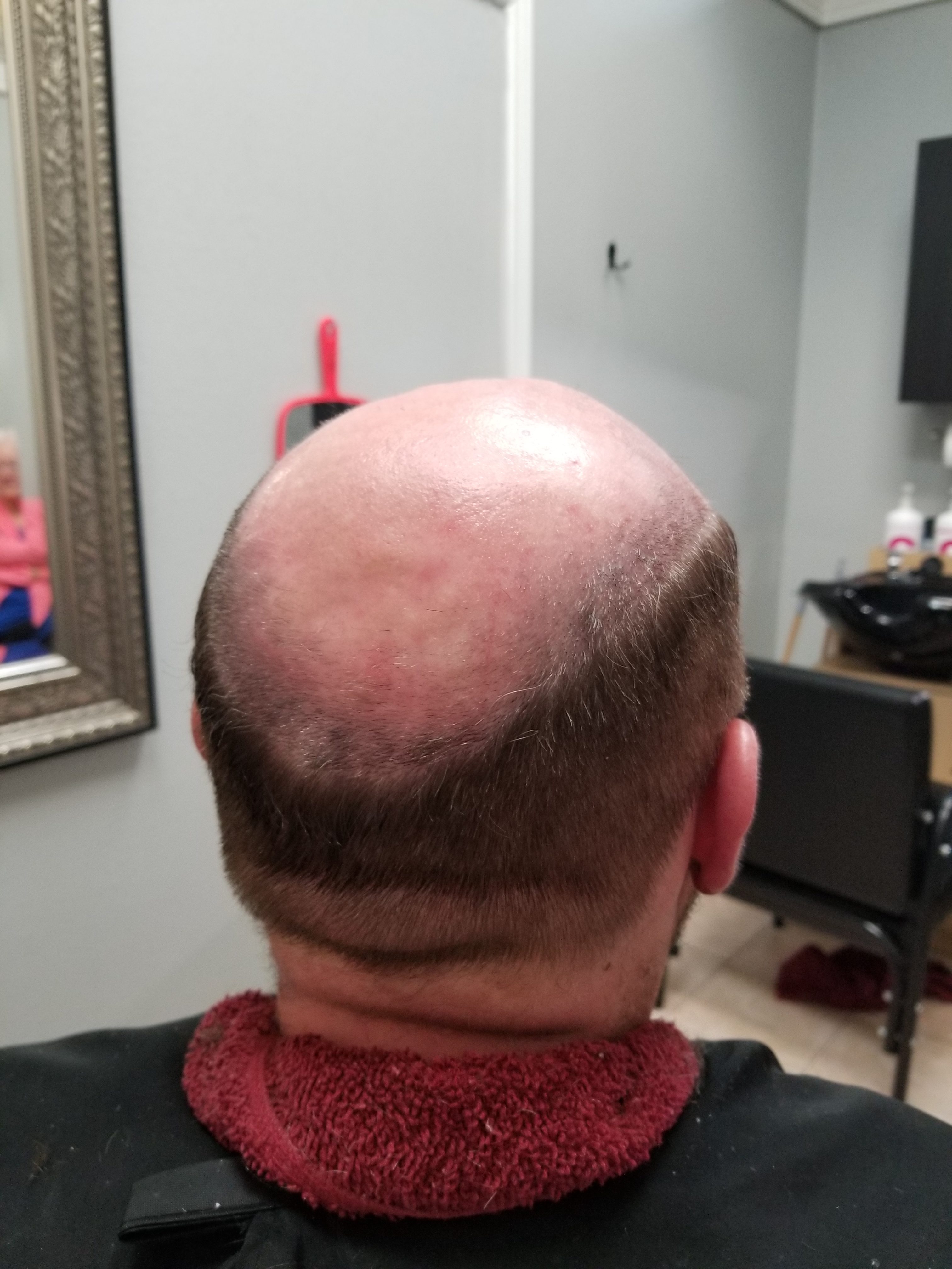 Client 1