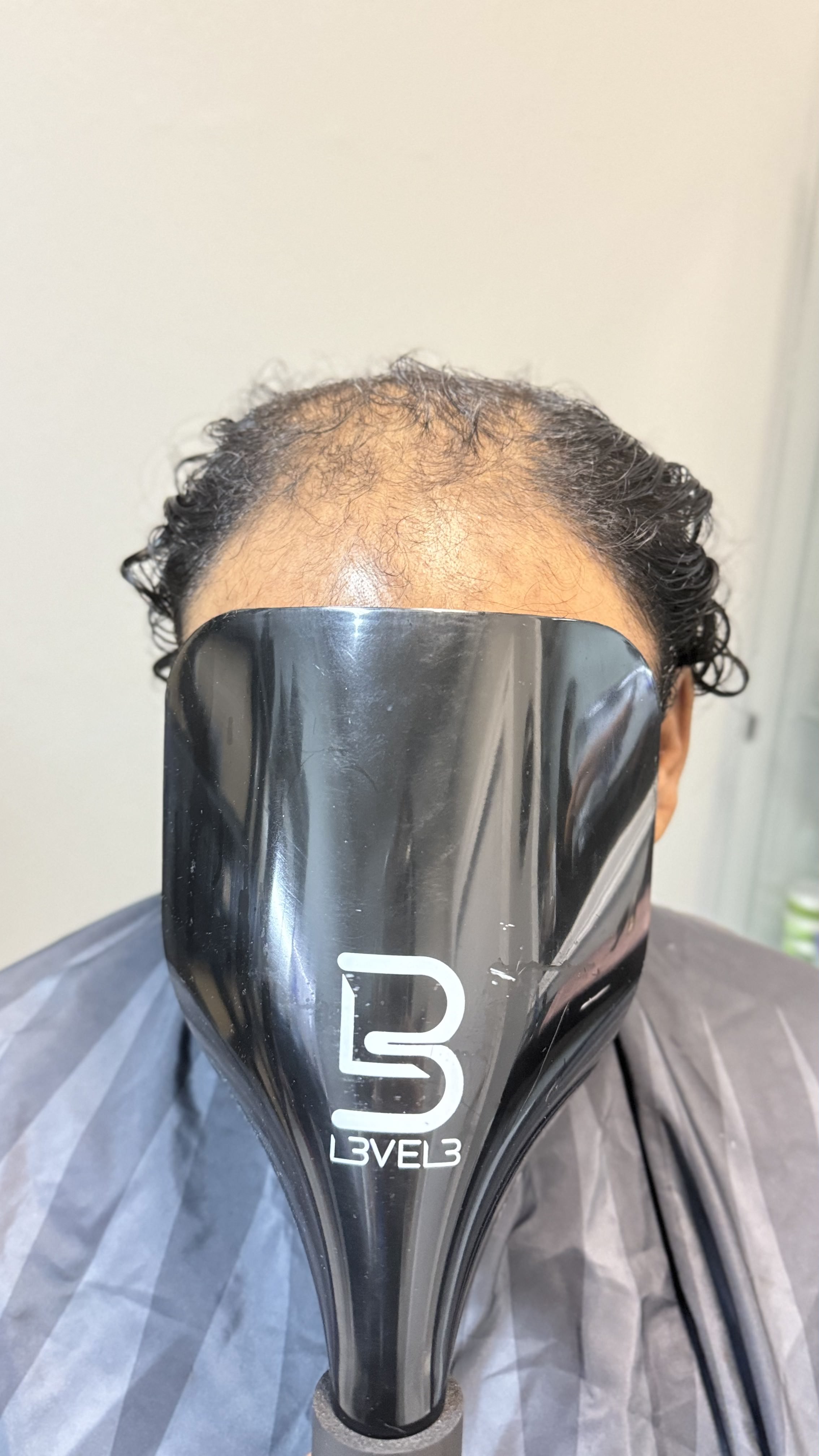 Client 3 Before