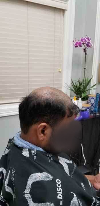 Client 3 Before