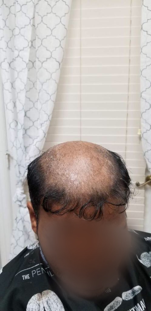 Client 3 After