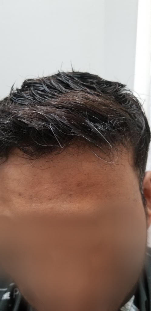 Client 3 After