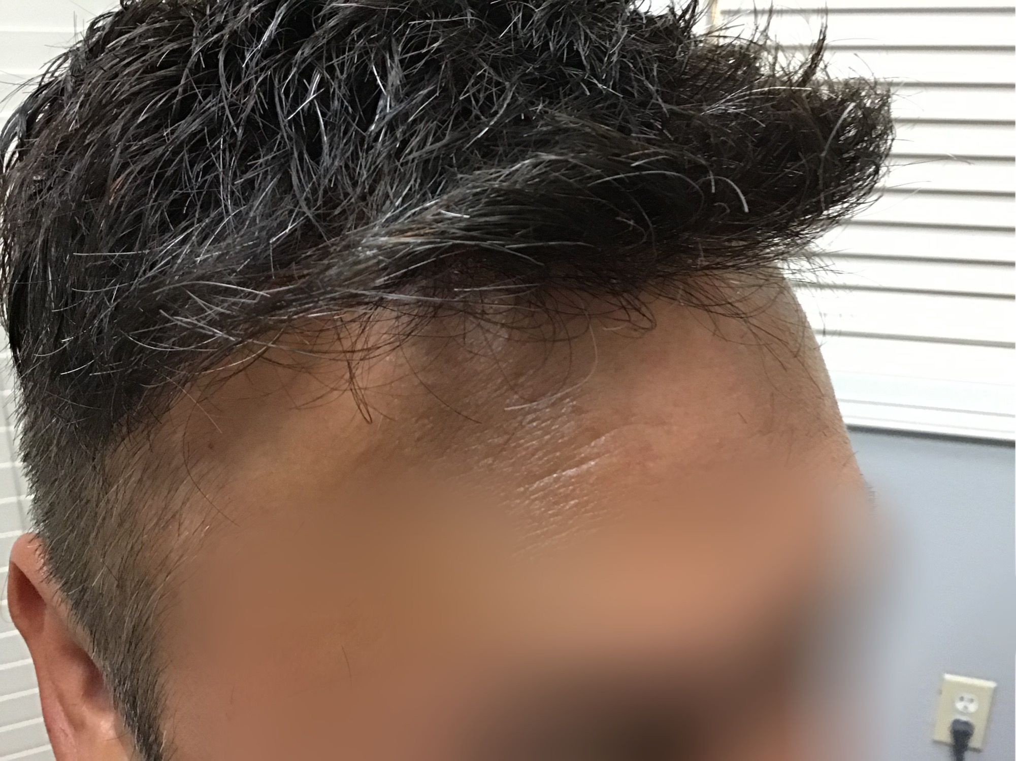 Client 3 After